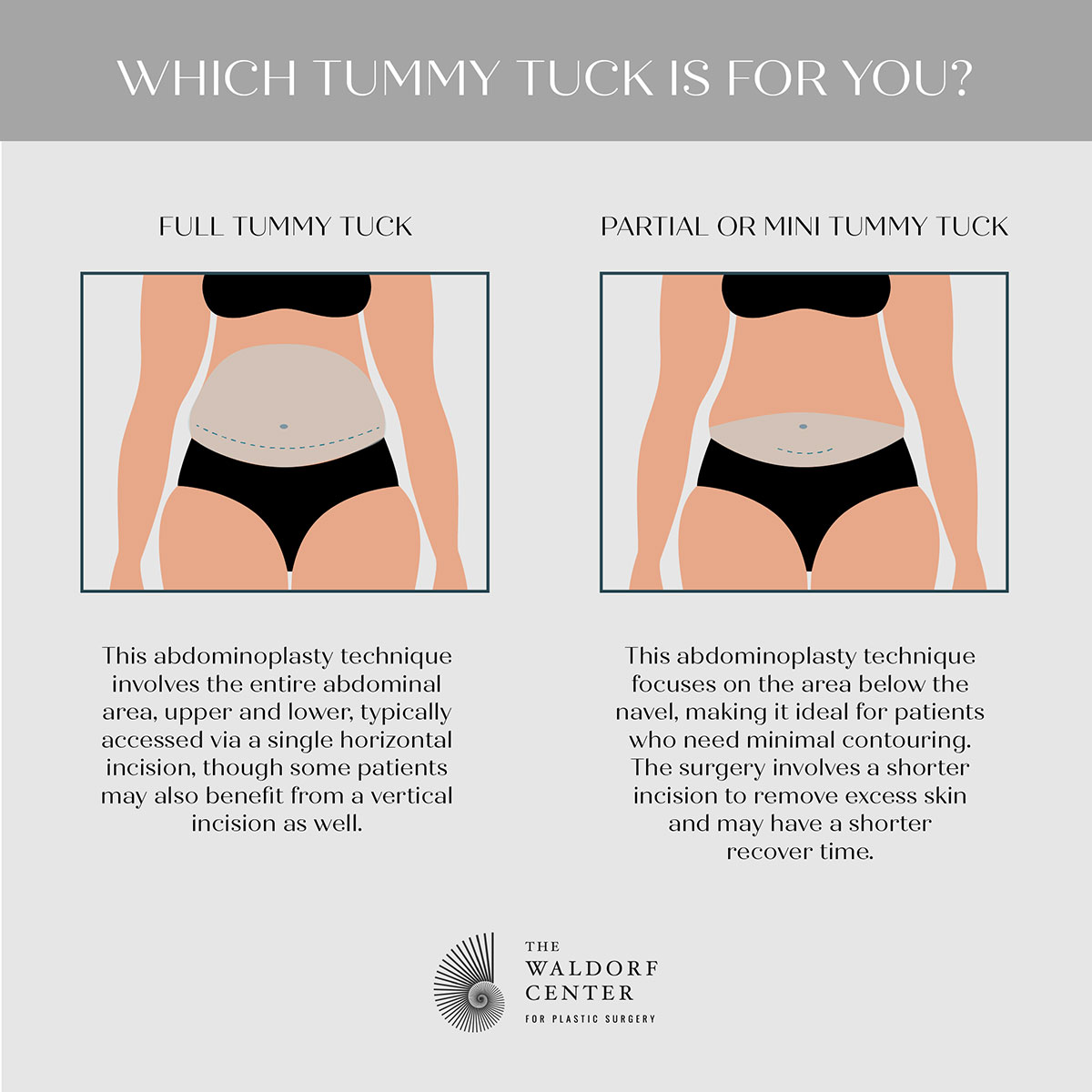 Tummy Tuck or Liposuction: What's the Difference, and Which Is